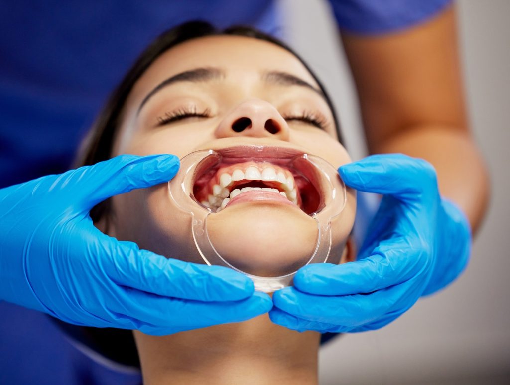 Arco Facial Bioart: Precisão no Registro e Assistência Garantida